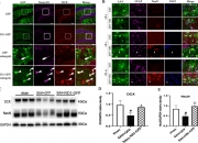 新研究在小鼠体内发现一种全新细胞