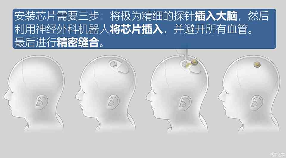我国科研人员开发新型植入式脑神经探针