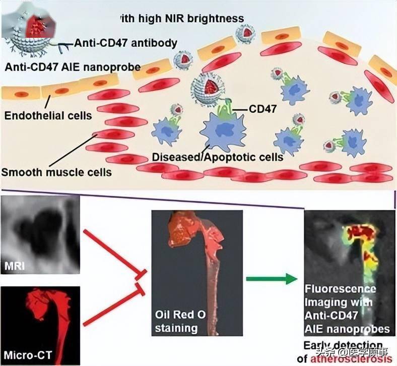 迈瑞医疗获得发明专利授权：“腹主动脉成像方法及相关设备”