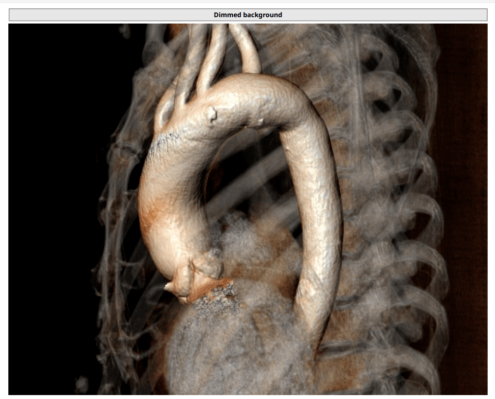迈瑞医疗获得发明专利授权：“腹主动脉成像方法及相关设备”