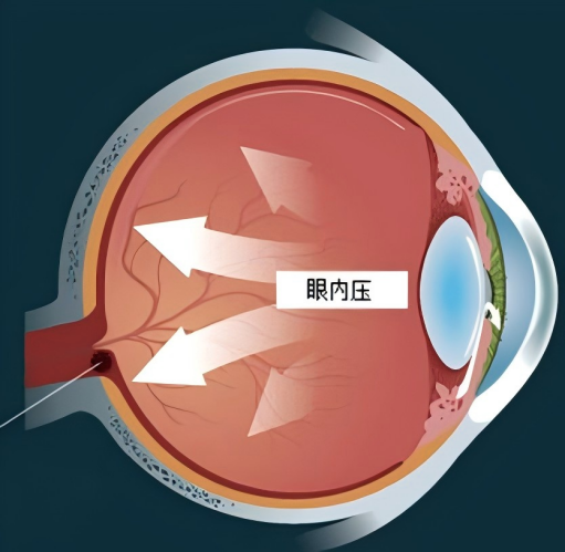 三大元凶引发跳水 后期策略